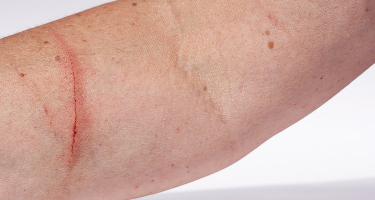 bloody injury on the arm